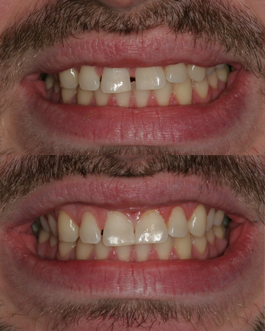 page top before and after image