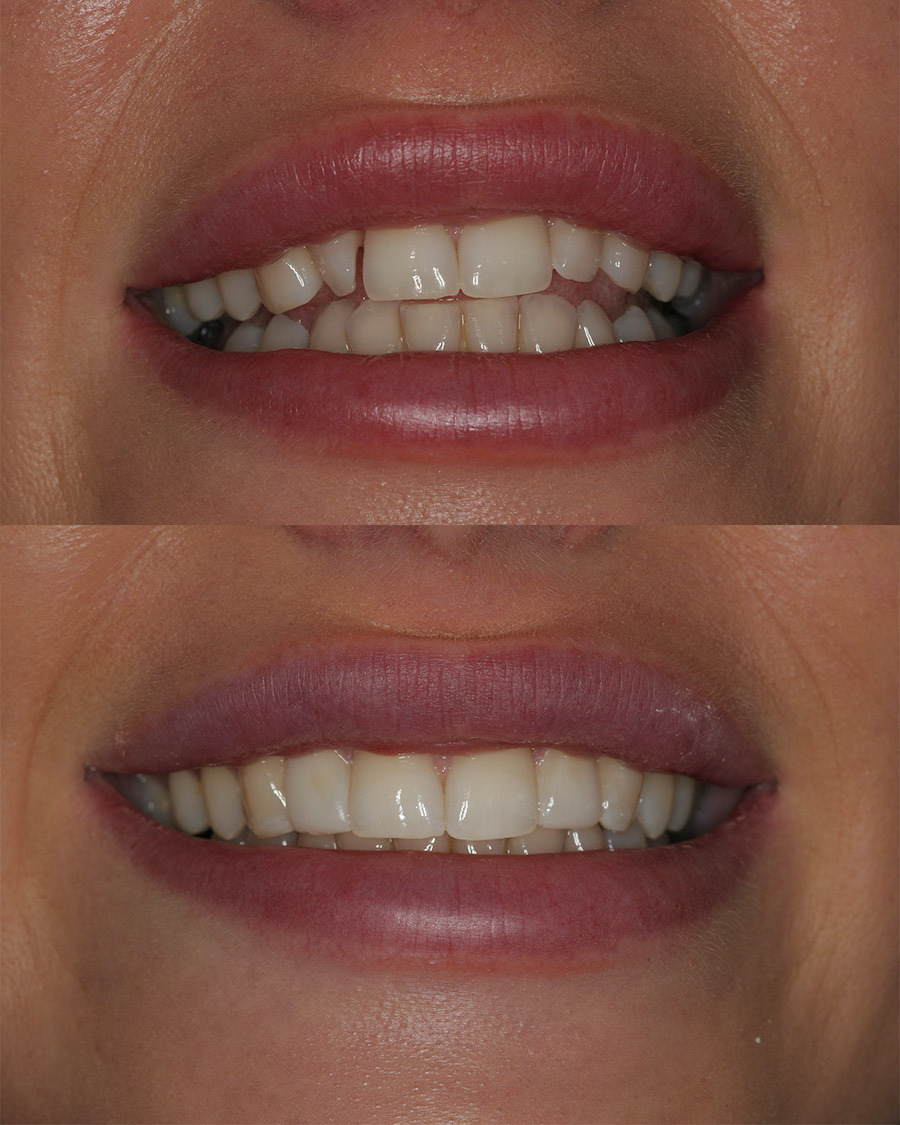 page top before and after image