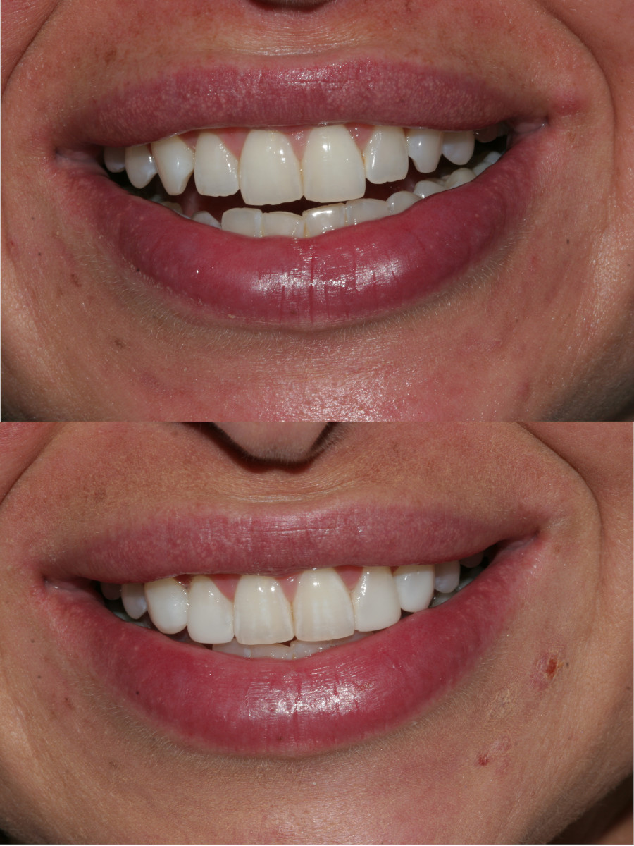 page top before and after image