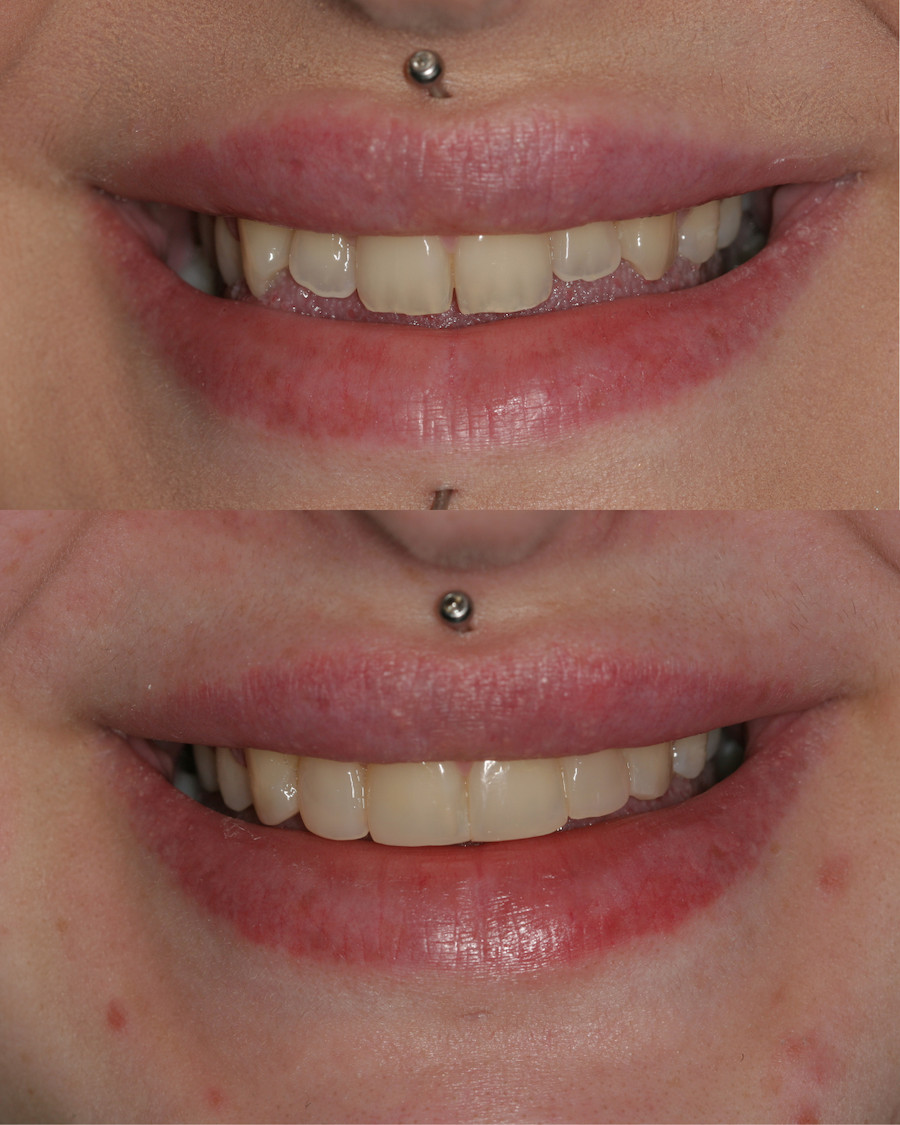 page top before and after image