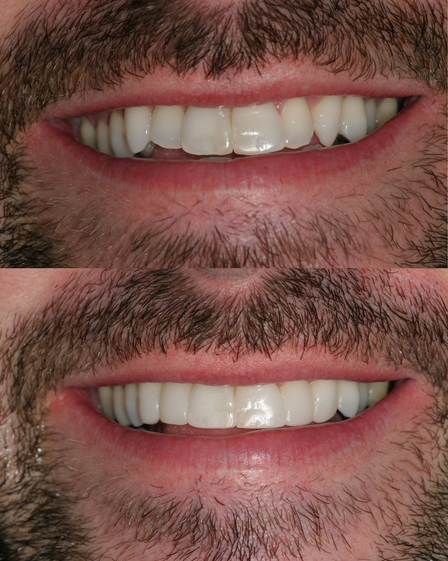 page top before and after image